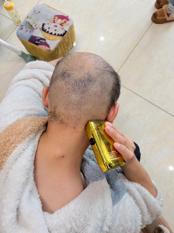 还在为剃光头烦恼？这玩意儿直接让你原地封神！