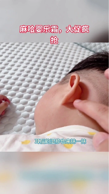 宝宝肌肤救星！红屁屁、湿痒、痱子全搞定！
