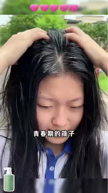 油头星人集合🏅 青少年专属洗发水免费送😘